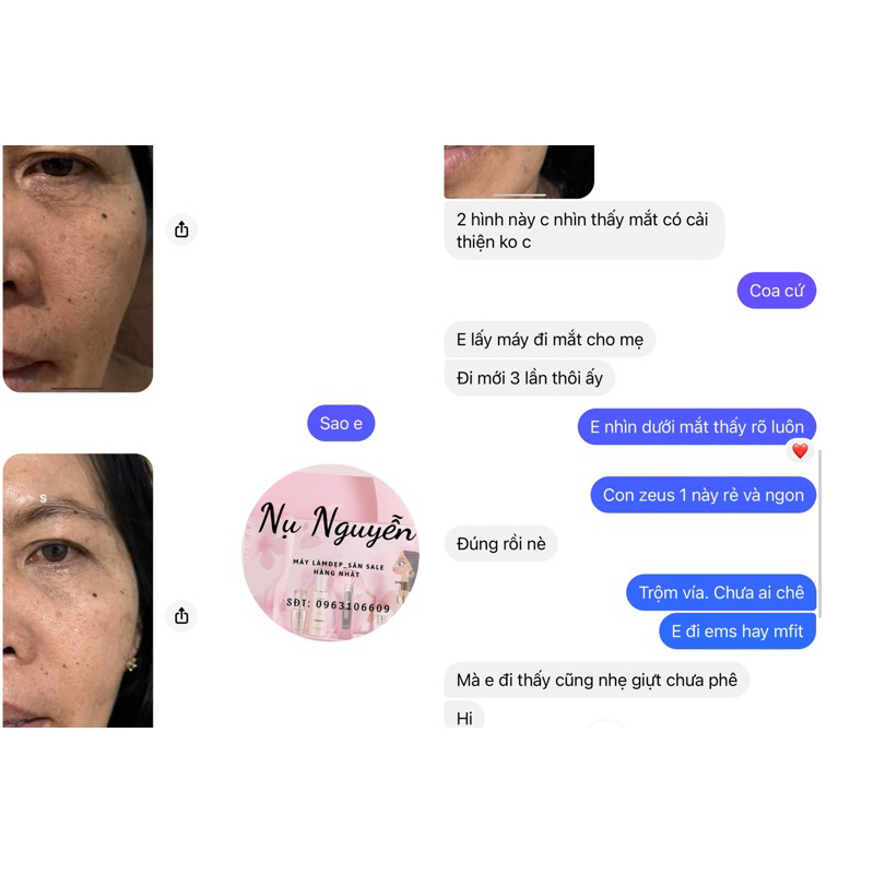 Máy nâng cơ Zeus 1