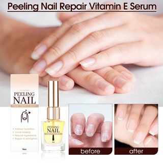Dưỡng móng peeling nail giúp hồi phục cải thiện móng hư tổn 15ml