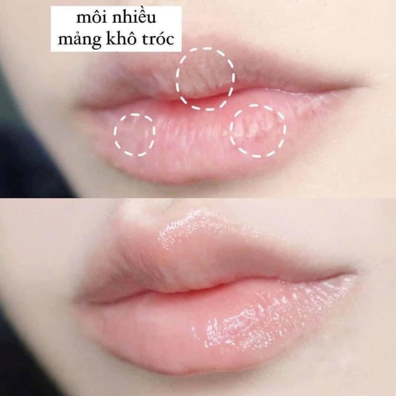 Combo Kem Tay Và Son Dưỡng Nuxe