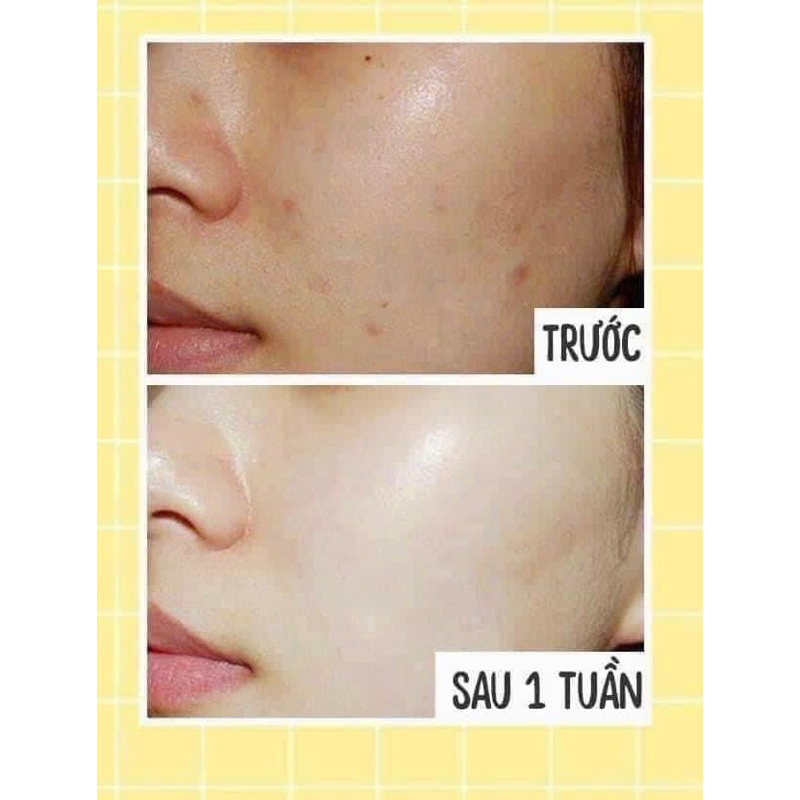 Kem Dưỡng Trắng Face HEMION