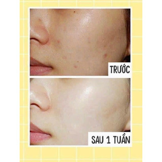 Kem Dưỡng Trắng Face HEMION [ Tặng Mặt Nạ ]