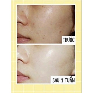 Kem Dưỡng Trắng face HEMION