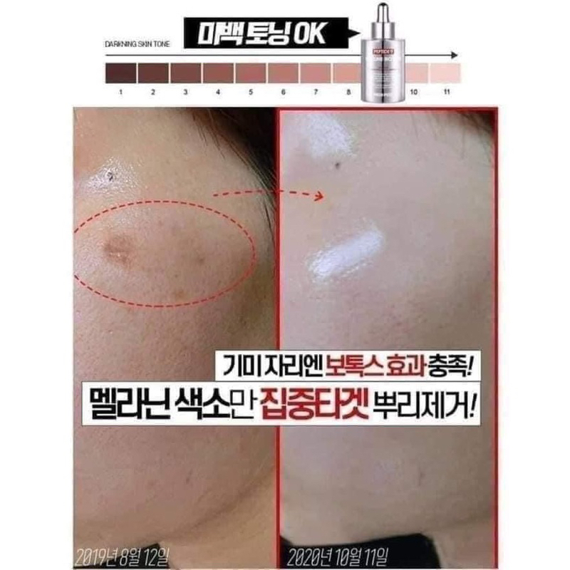 Tinh Chất Căng Bóng Làm Sáng Trẻ Hóa Medipeel Medi peel Peptide 9 Volume Bio Tox Biotox 100ml