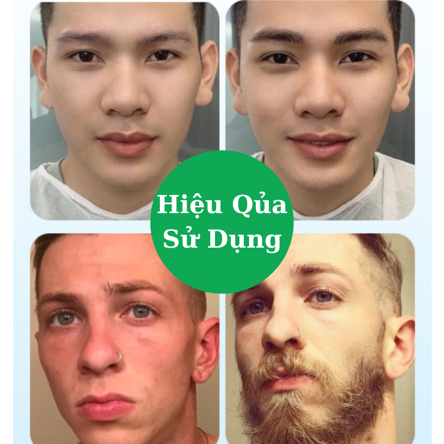 Huyết Thanh Kích Thích Mọc Lông ANRAN Nhật Bản - Serum ANRAN Kích Thích Mọc Tóc, Râu, Lông Mày, Lông Mi 6ML