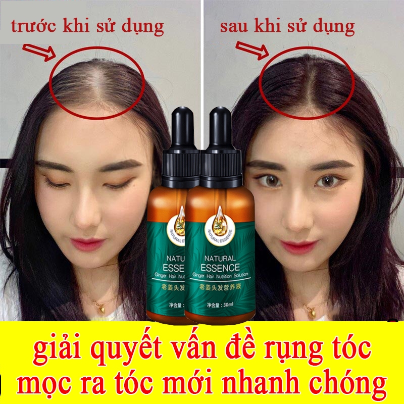 Tinh chất mọc tóc tinh dầu mọc tóc 30ml serum kích mọc tóc chăm sóc tóc chống rụng tóc,kích thích tó