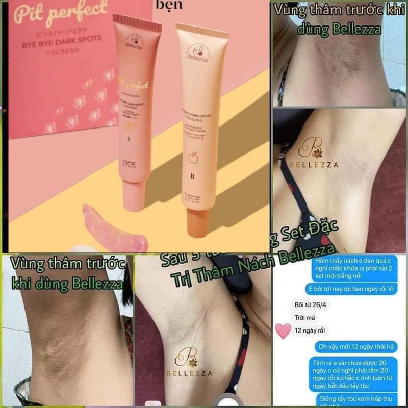 Thâm Nách - Thâm Bẹn