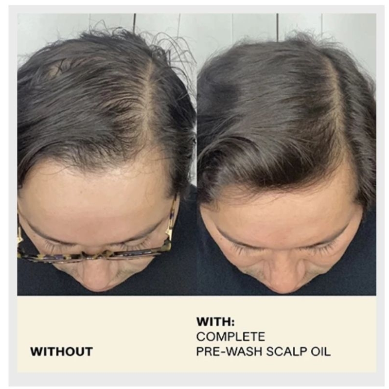 Dầu dưỡng da đầu trước khi gội JVN Complex Pre wash scalp oil