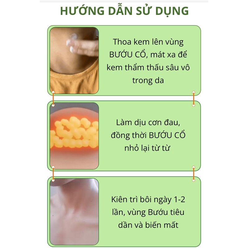 Kem Lăn Thảo Dược U Tuyến Giáp South Moon - Kem Bôi Hỗ Trợ Tan U Bứu, Cường Giáp, Dứt Điểm U Tuyến Giáp