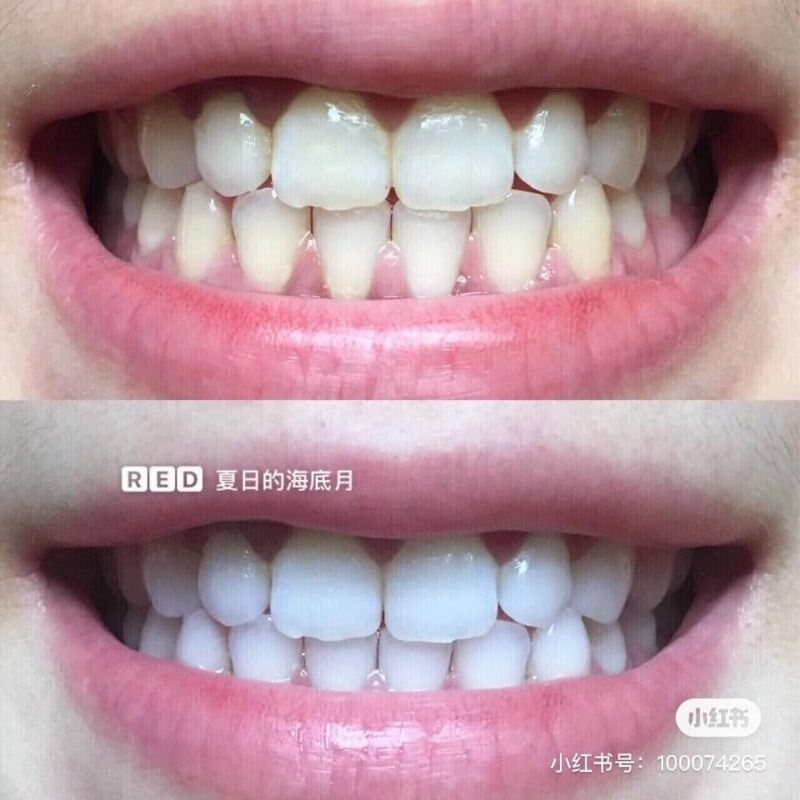 Kem đánh răng Crest WhiteLock 3D Hoa Anh Đào/Quả Đào 120g