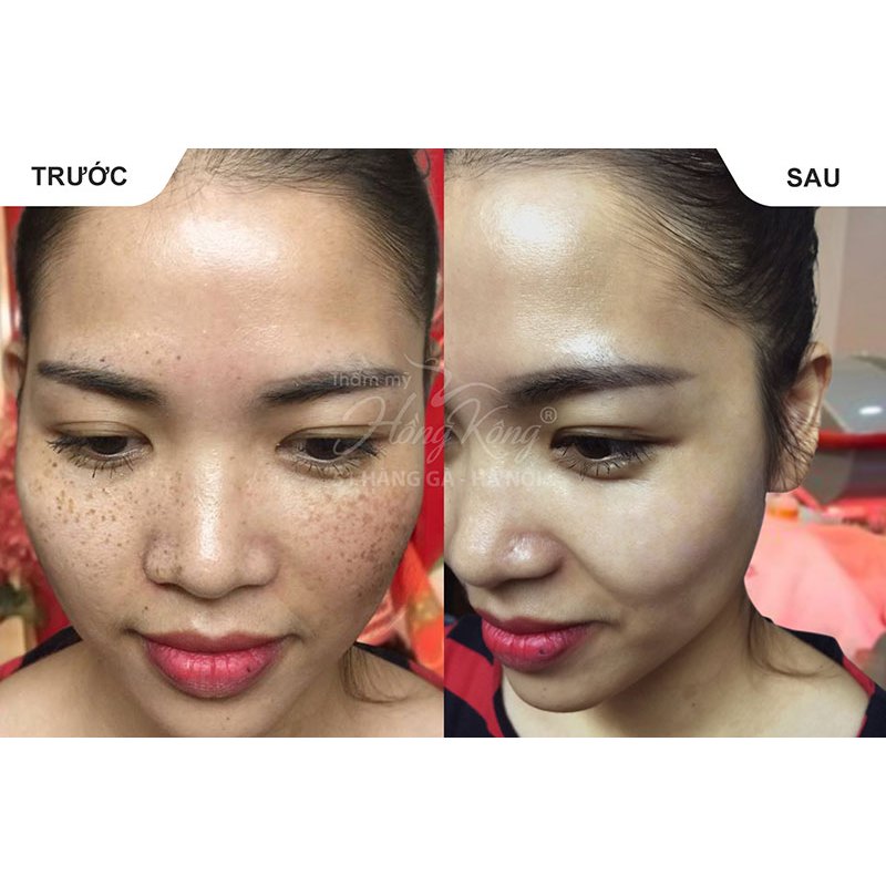 Kem CM nhân sâm đỏ ChiuMien, dưỡng trắng da, sáng da, ngăn ngừa nếp nhăn SPF50 - 50g