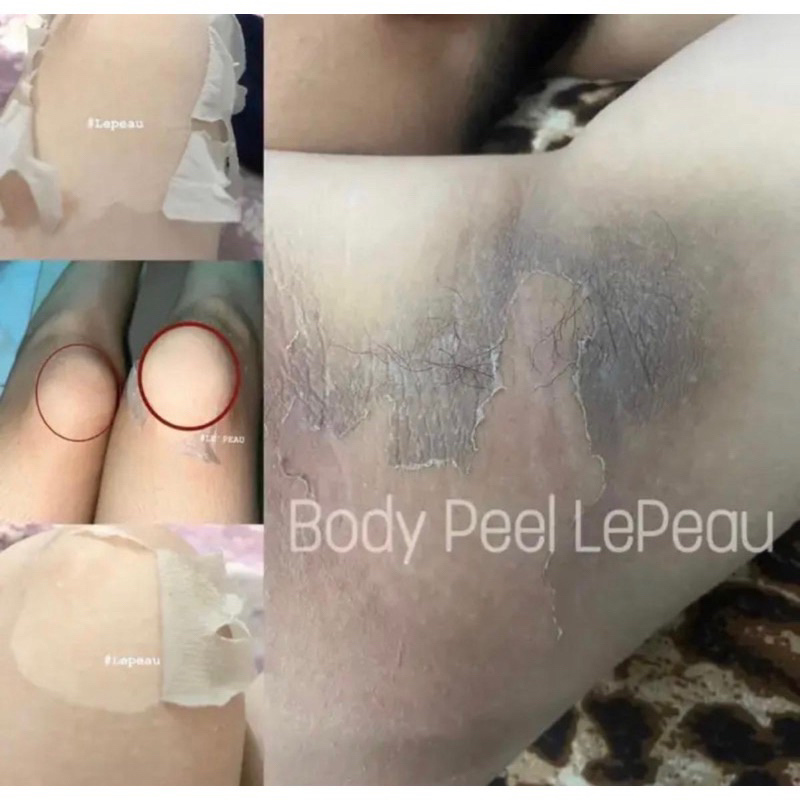 Peel nách retinol, peel body trắng da mờ thâm sau 7 ngày, kem dưỡng ẩm 150ml - LEPEAU