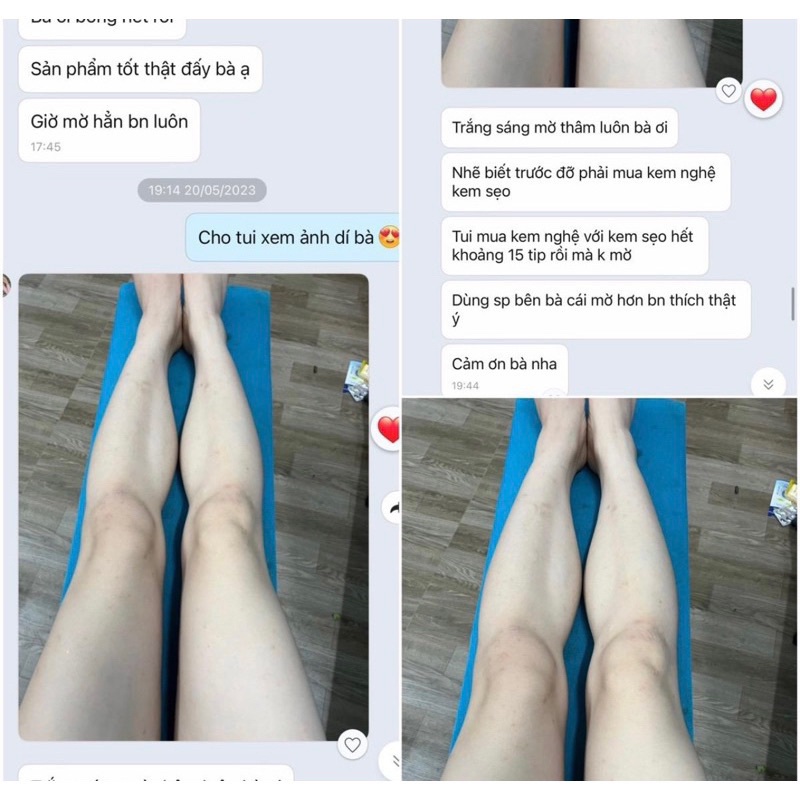 Peel nách retinol, peel body trắng da mờ thâm sau 7 ngày, kem dưỡng ẩm 150ml - LEPEAU
