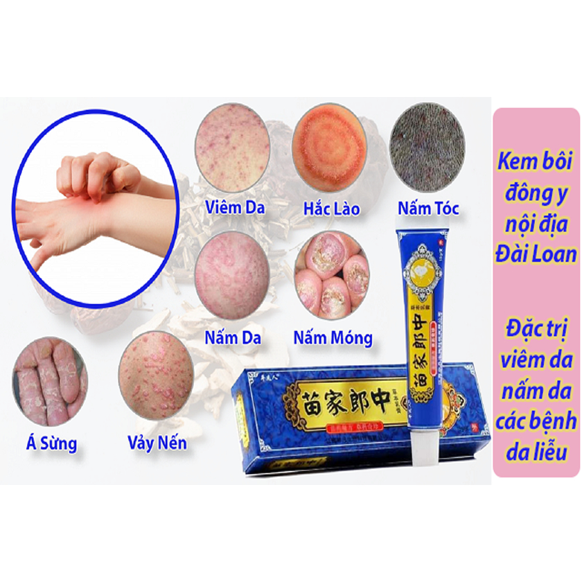 Kem Bôi Nấm Xanh - Kem Bôi Ngoài Da