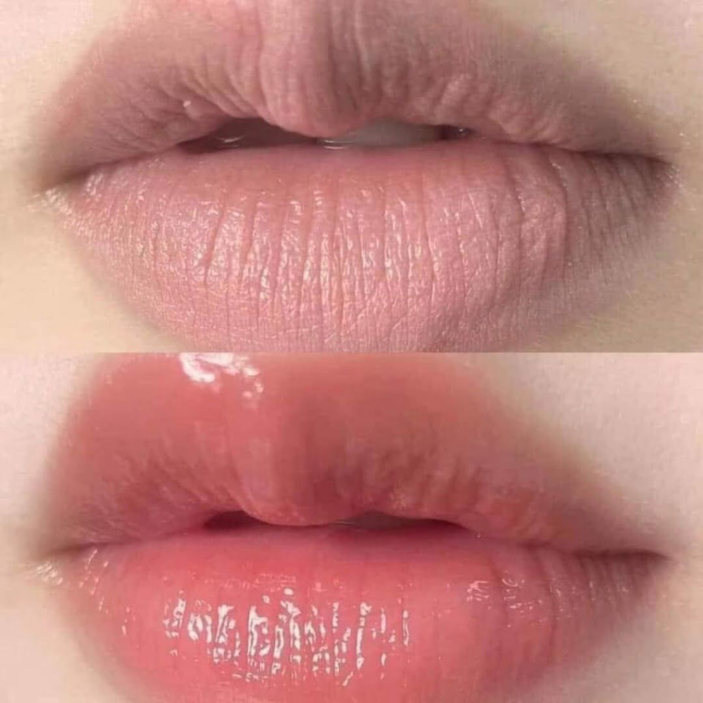 Son Dưỡng Mediheal /Mediheal Labocare Panteno Lips 10ml