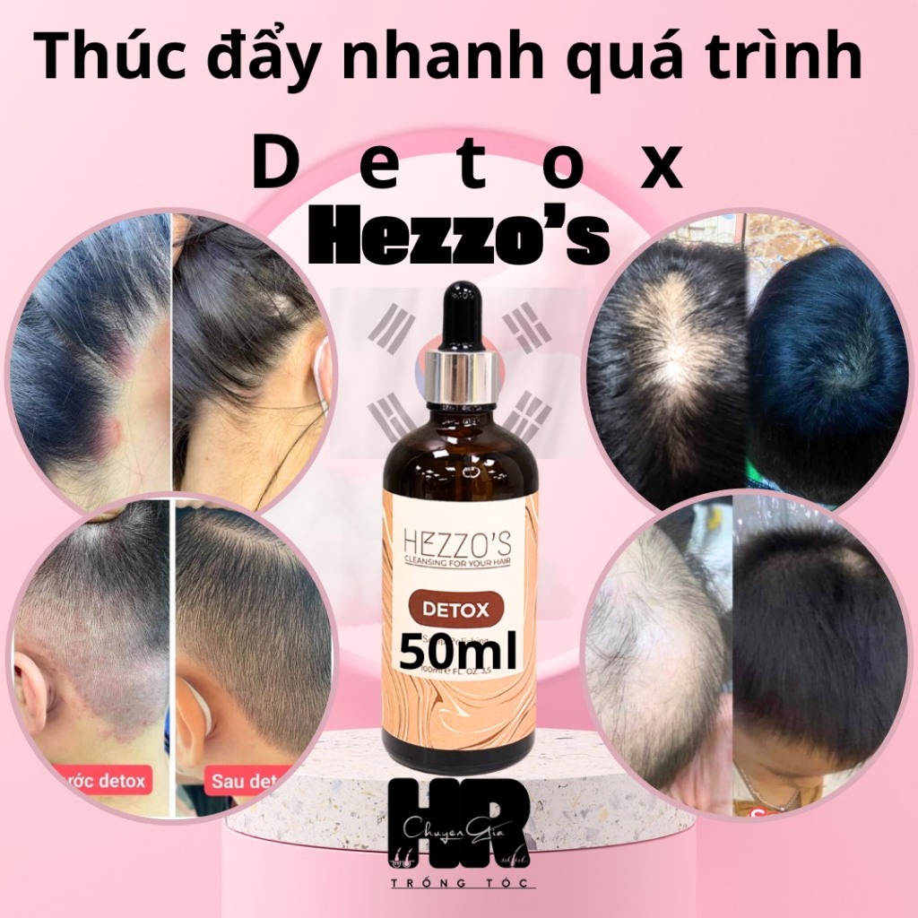 Detox Da Đầu Hezzo's HQ thải bã nhờn bong,bong tế bào chết,  50ml