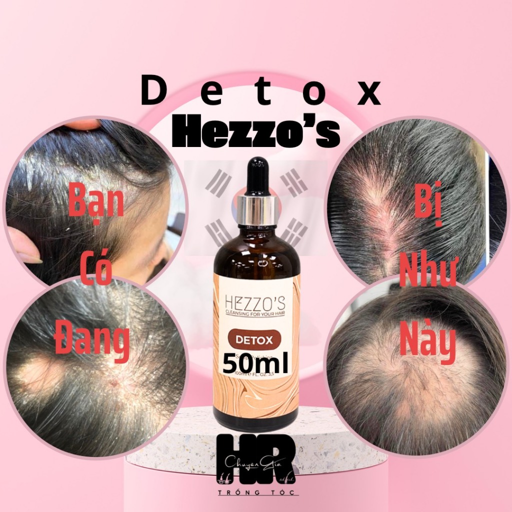 Detox Da Đầu Hezzo's HQ thải bã nhờn bong,bong tế bào chết,  50ml