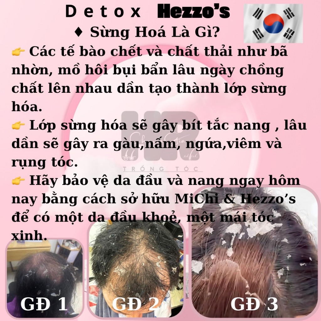 Detox Da Đầu Hezzo's HQ thải bã nhờn bong,bong tế bào chết,  50ml