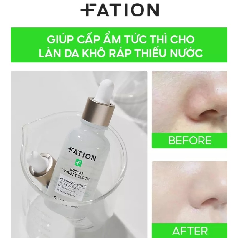 Tinh Chất Làm Dịu Da Fation Nosca9 Trouble Serum 30ML