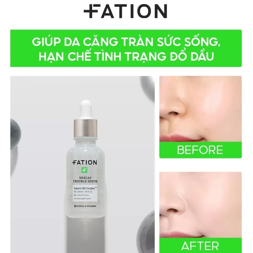 Tinh Chất Làm Dịu Da Fation Nosca9 Trouble Serum 30ML