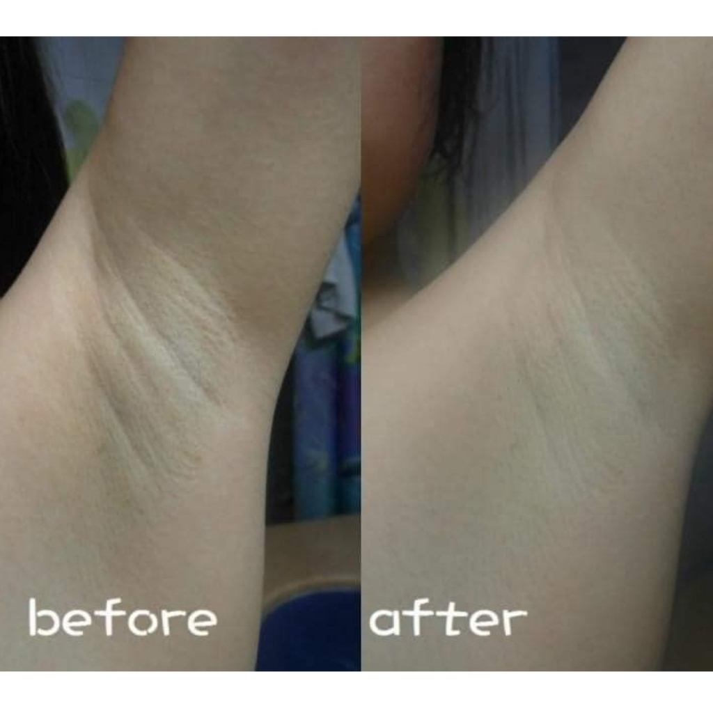 Kem Dưỡng Trắng Giảm Thâm Nách Precious Skin Alpha Arbutin Organic Underarm Whitening Cream 50g Chính Hãng