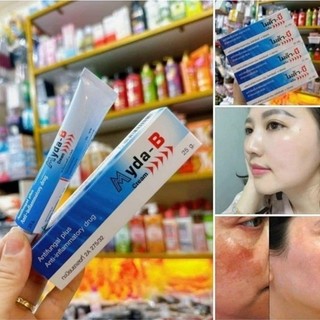 Kem bôi nám, tàn nhang myda-b thái lan 25gr