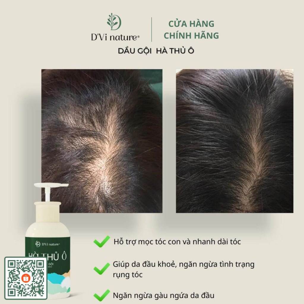 Hà thủ ô cô viên D'Vi nature thảo dược giúp nuôi dưỡng sợi tóc từ sâu bên trong, hỗ trợ mọc tóc, đen tóc, sợi tóc dày