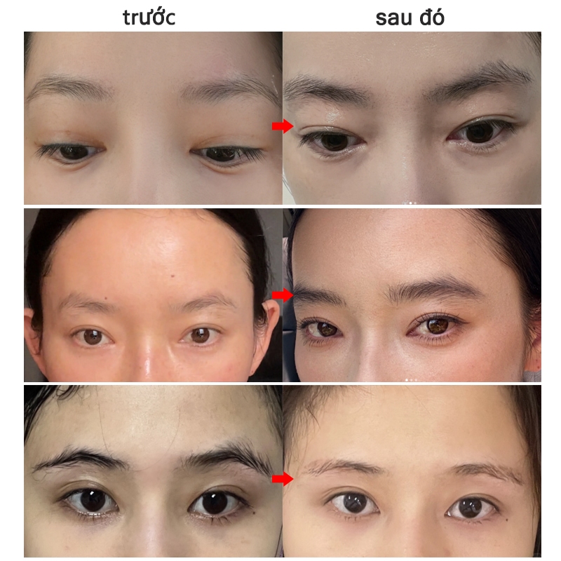 Serum mọc lông mày tinh chất kích mọc lông mày, lông mi,lông râu,mọc tóc,thúc đẩy lông mày dày và dài