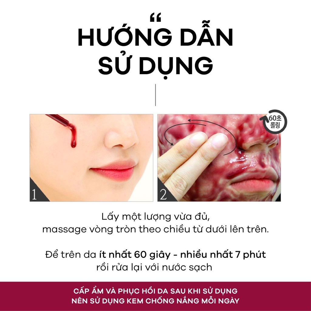 Tinh Chất Tái Tạo Da So’ Natural Red Peel Tingle Serum