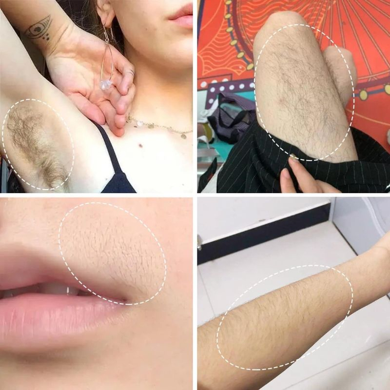 Máy cạo lông mini cầm tay và serum triệt lông  nách, tay, chân, body  bikini, máy cạo lông đa năng cho nam và nữ