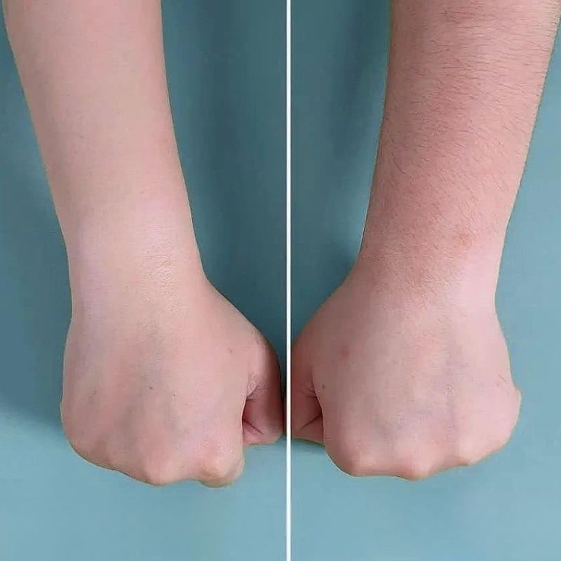 Máy cạo lông mini cầm tay và serum triệt lông  nách, tay, chân, body  bikini, máy cạo lông đa năng cho nam và nữ