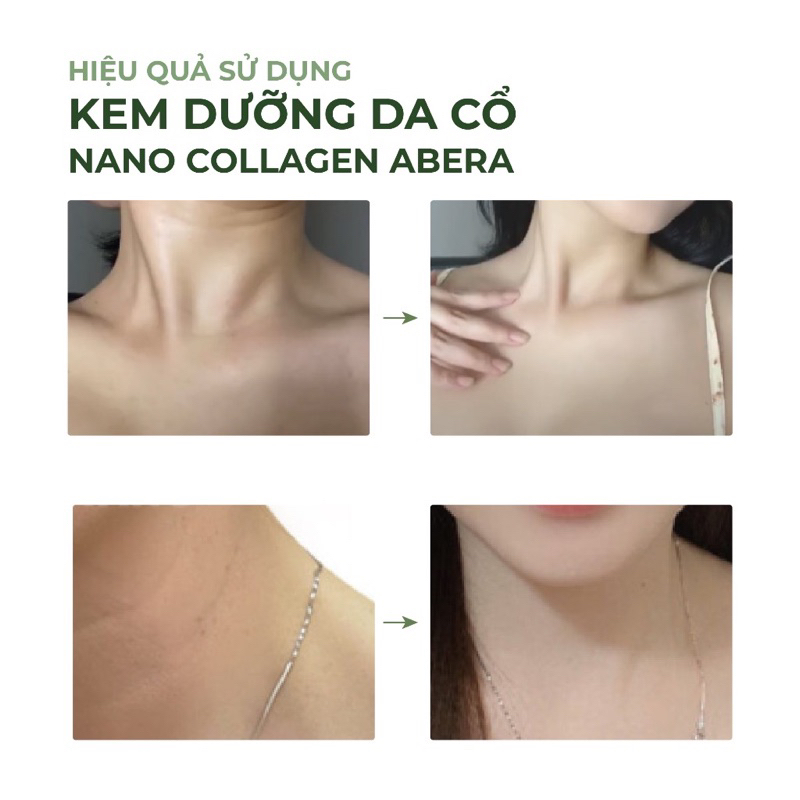 Kem Dưỡng Da Cổ Loka Nano Abera 50ML Có Lăn Massage chăm sóc, phục hồi da cổ, lấy lại sự đàn hồi của tuổi xuân
