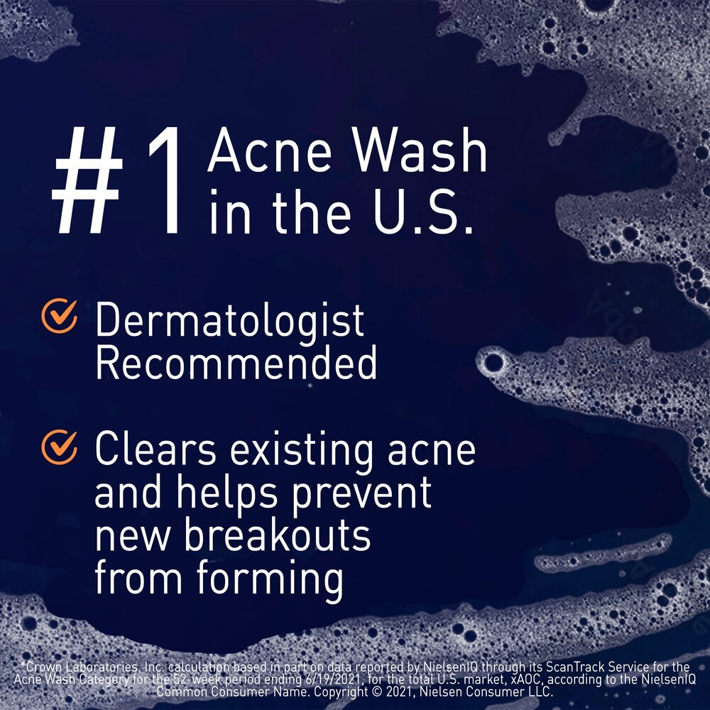 Sữa rửa mặt hỗ trợ giảm mụn PanOxyl Foaming Acne Wash Maximum Strength 10% Benzoyl Peroxide 156g