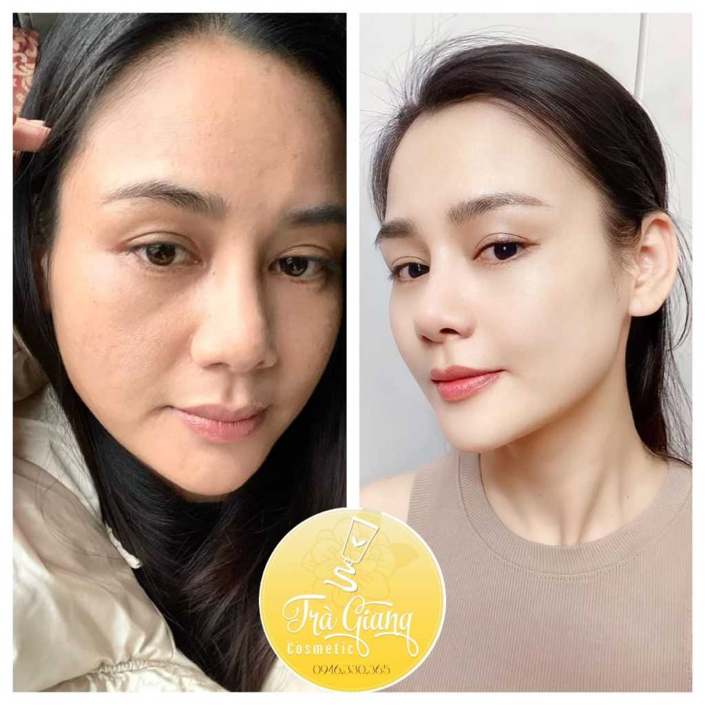 Viên căng bóng sáng da cấp nước chống oxy hóa Her Own