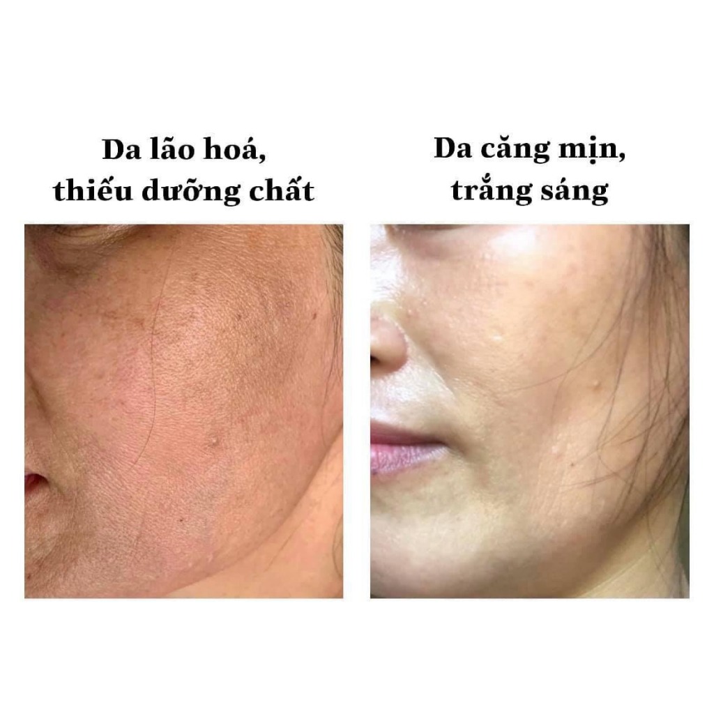 Kem phân huỷ nám Lightening  30gr xanh lá Mẫu mới 2023