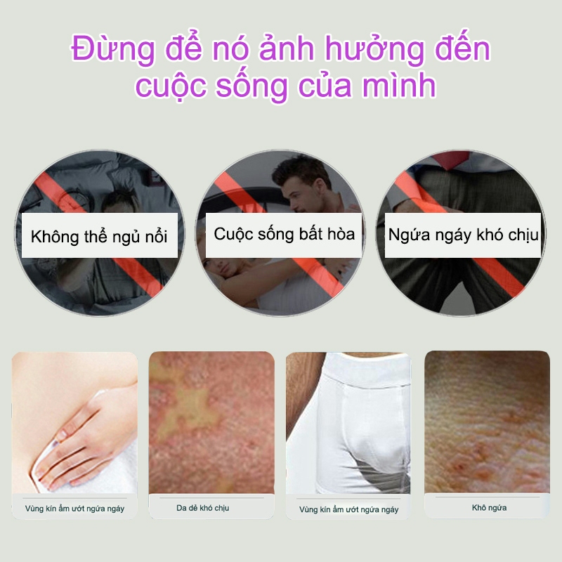 Kem bôi vảy nến thảo dược bôi vảy nến chàm ngứa kem bôi chàm ngứa 30g giảm ngứa nhanh chàm viêm da hắc lào ngứa âm đạo