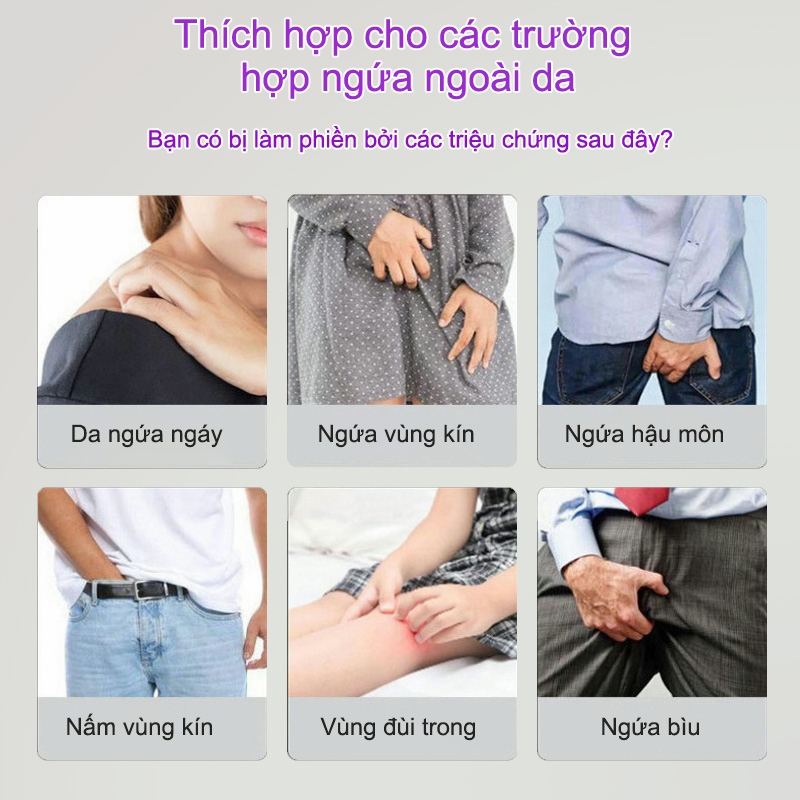 Kem bôi vảy nến thảo dược bôi vảy nến chàm ngứa kem bôi chàm ngứa 30g giảm ngứa nhanh chàm viêm da hắc lào ngứa âm đạo