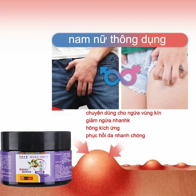 Kem bôi vảy nến thảo dược bôi vảy nến chàm ngứa kem bôi chàm ngứa 30g giảm ngứa nhanh chàm viêm da hắc lào ngứa âm đạo