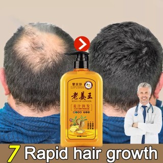 Dầu gội kích mọc tóc Dầu gội chống rụng tóc Dầu gội gừng Dầu gội đầu làm rậm tóc Ngăn rụng tóc và dưỡng tóc Kích thích m