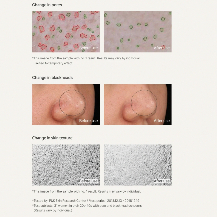 Siêu mặt nạ chăm sóc lỗ chân lông innisfree Super Volcanic Pore Clay Mask 2X 100ml