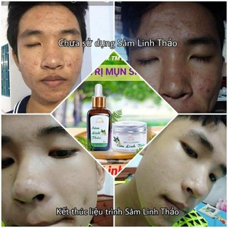 (Không Vỏ hộp) Bột nạ thảo dược Sâm Linh Thảo