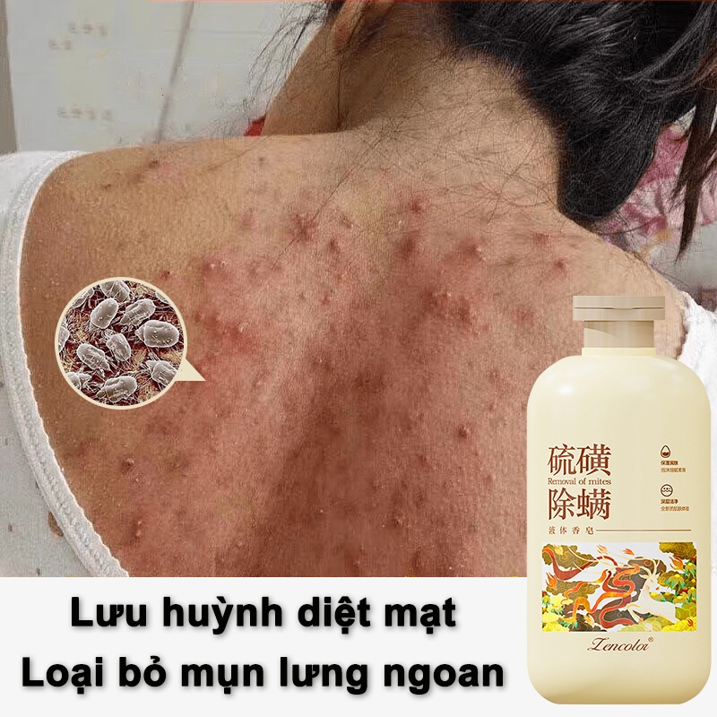 sữa tắm trắng da sữa tắm mụn lưng sữa tắm lưu hương 500ml Làm sạch sâu làm trắng dưỡng ẩm loại bỏ mụn trứng cá
