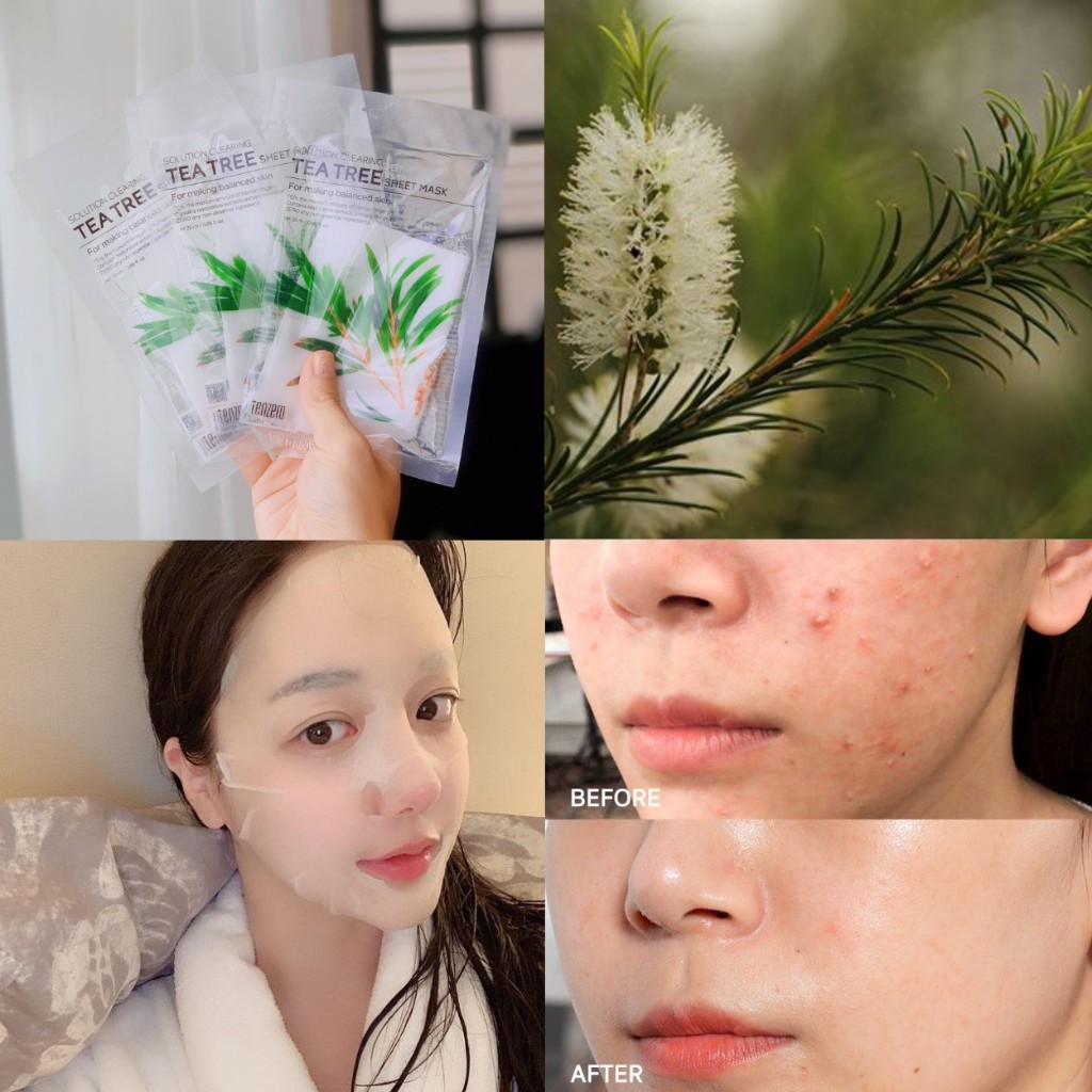 Mặt nạ giấy trong suốt Tenzero dưỡng ẩm và phục hồi cho da 25ml