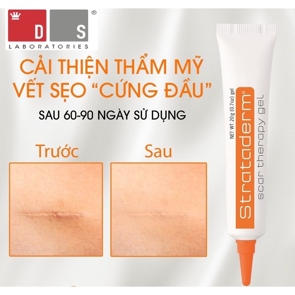 Kem xoá Sẹo Thâm, lấp đầy Sẹo Rỗ, Sẹo Lõm, Sẹo Lồi Strataderm 10g Thuỵ Sĩ