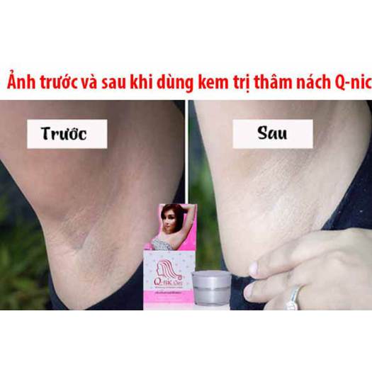 Kem Giảm Thâm Nách QNIC CARE- 15Gr - Mẫu Mới