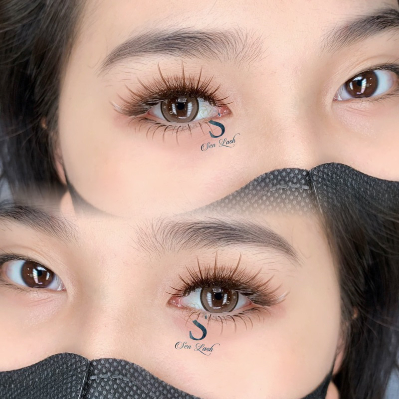 Mi dưới Senlash độ cong J, B 0.07