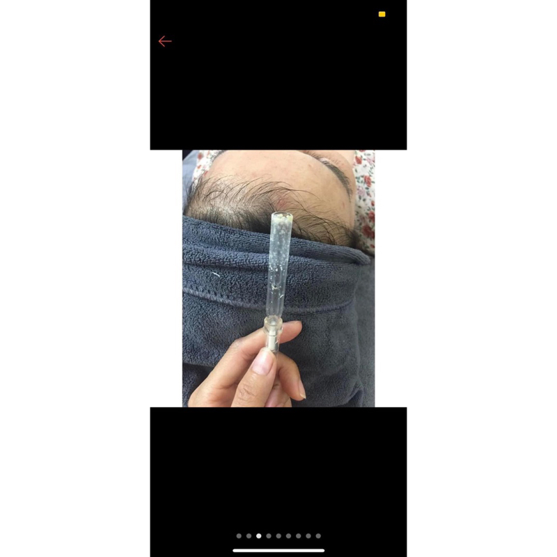 Ống Hút Mụn Thủy Tinh combo 10 cái - Ống Hút Mụn Hút Dầu Cho Máy Hút Mụn, Máy Đa Năng