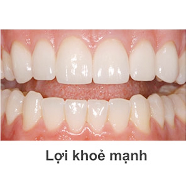 Combo 2 Kem Đánh Răng Muối Tre Chăm Sóc Nướu Số 1 Hàn Quốc 140g