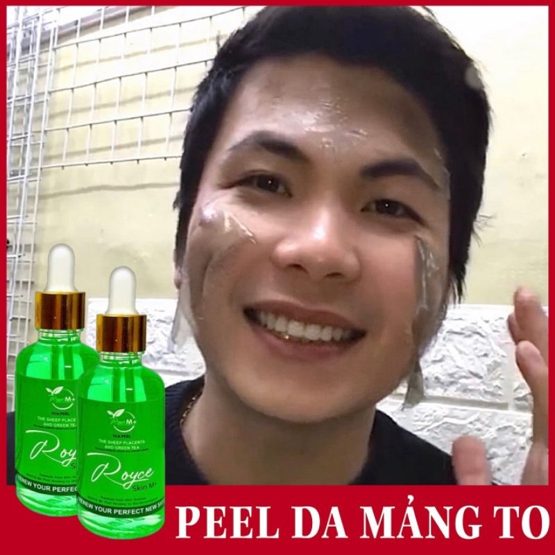 Peel da ROYCE SKIN M+ Peel da sành điệu nhất .