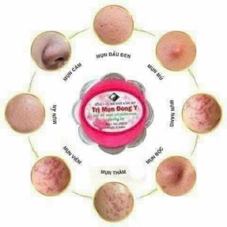 Kem mụn đông y hoa anh đào mẫu mới