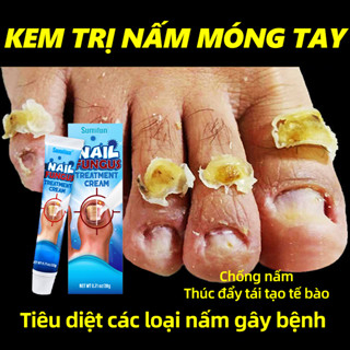 Tinh chất nấm móng tay chân, dứt điểm KT2